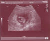 Eco_2007-04-25_14semanas.jpg (56193 bytes)